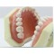 Nissin 500 type dental typodont model
